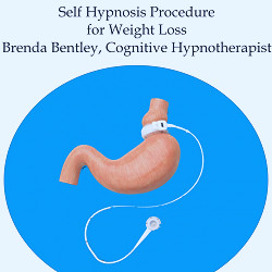 Virtual Gastric Band Procedure for Weight Loss - song and lyrics by Brenda  Bentley | Spotify